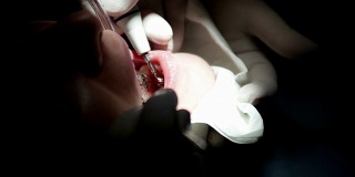 牙医在一个妇女的口腔内操作清洁和控制她的牙齿