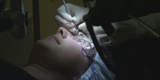 激光眼科手术第七步:外科医生切除激光角膜瓣