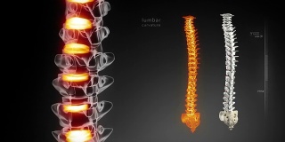 人体脊柱医学扫描