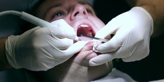 牙科医生在牙齿上钻孔时按住病人的下巴