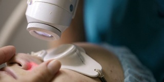 激光皮肤治疗的微距镜头