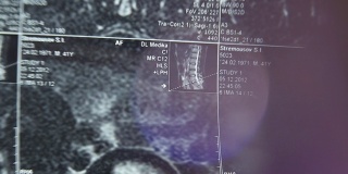 病人看他的x光片