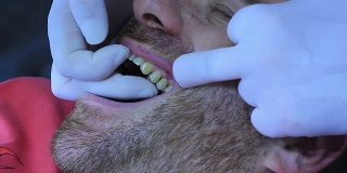 牙医-植牙