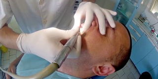 牙科医生使用牙钻准备种植、假牙的特写