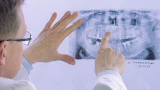 牙医看牙科x光板的特写视频素材模板下载