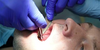 牙科植入手术