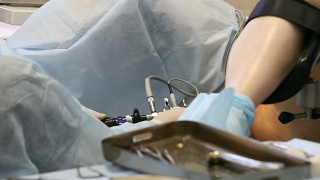 手术室里的妇科手术视频素材模板下载