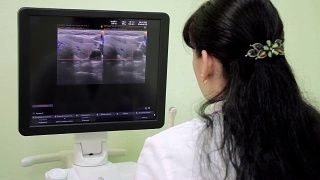 女医生放射学家在医院的电脑显示器屏幕上分析医学影像。放射学病房。放射科医生对病人进行了分析。医生进行体检视频素材模板下载