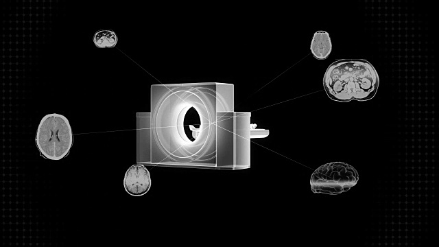 x射线CT扫描仪，医学MRI