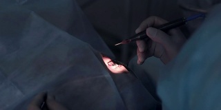 医生的手在医院的手术室里做手术