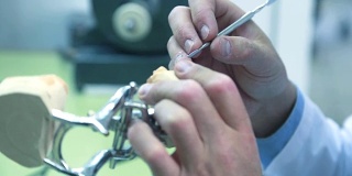 牙科技师用手术刀去除假牙上多余的蜡