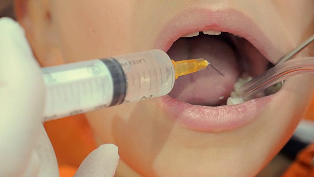 牙医用注射器和吸尘器在孩子嘴里操作