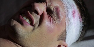 一个头部受伤的人躺在床上。缠着绷带。脸上有淤青。
