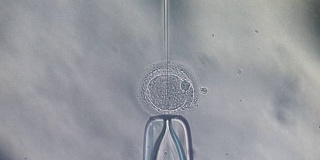 胞浆内精子注射体外受精ICSI细胞实验