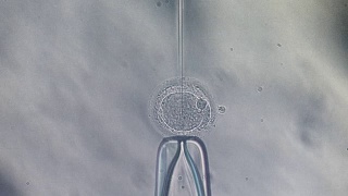 胞浆内精子注射体外受精ICSI细胞实验视频素材模板下载