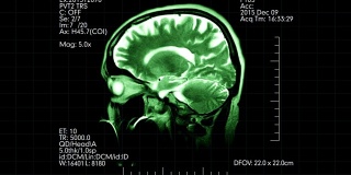 绿色侧视图MRI脑部扫描显示动态医疗数据