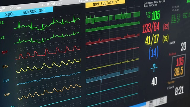 ICU监护仪显示患者病情、高烧、心律失常、病情