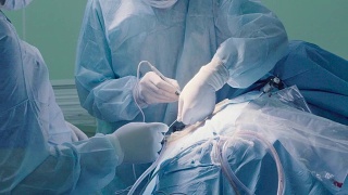 腹部手术腹部的外科手术视频素材模板下载