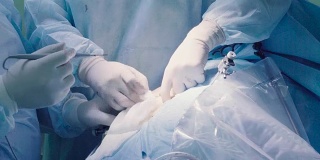 腹部手术腹部的外科手术