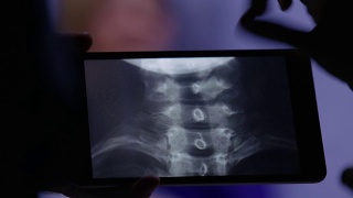 医生在平板电脑上检查x光片视频素材模板下载