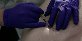 手术切除胎记前，医生在胎记周围注射局麻药