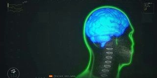 患者脑部扫描测试结果显示，疾病诊断与预防