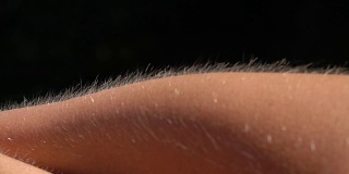 近距离微距景深:皮肤起鸡皮疙瘩的细节，女性手臂上的毛发上升