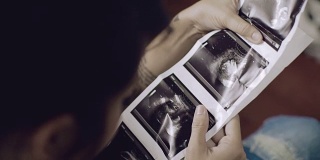 孕妇的超声波图像