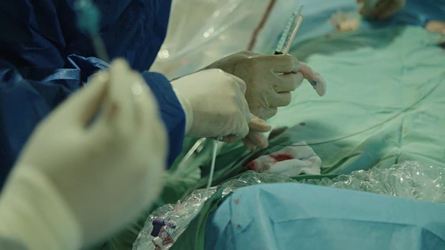 在医院的外科病房里，正在进行心导管插入术的医生们