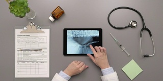医生在平板电脑上检查脊柱x光片的俯视图