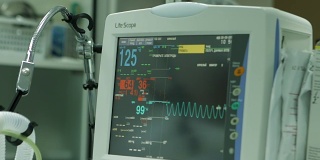 手术室患者心电图监测