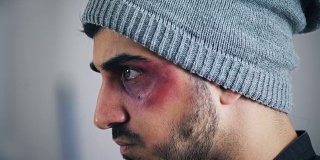 一个脸上受伤的年轻男子的侧面，特写