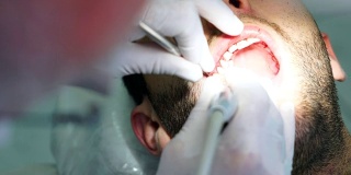 牙医在男人的牙齿上钻孔