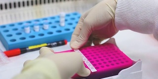 PCR技术的研究