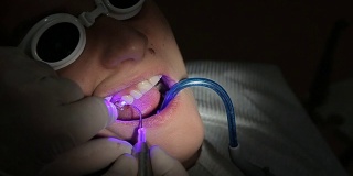 牙科医生临床用牙科治疗仪检查女性患者