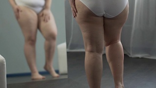 有体重问题的女孩在镜子里看着自己的腿，用手抚摸它们视频素材模板下载
