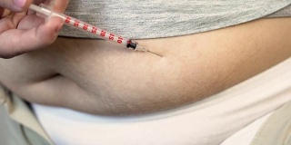 特写超重女性注射胰岛素到胃部，糖尿病