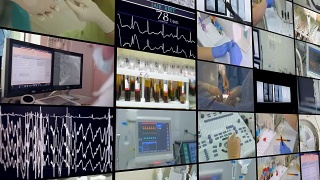 医疗场景。视频墙，多屏医学影像剪辑。视频素材模板下载