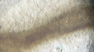 曲霉属真菌在显微镜下视频素材模板下载