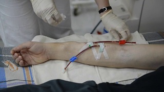 护士准备病人的手臂进行透析视频素材模板下载