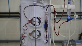 带管子的血液透析机。视频素材模板下载