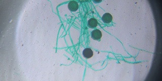 显微镜下的黑根霉