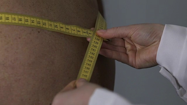 营养师手测量肥胖患者的腰围，节食减肥