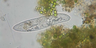 尾草履虫是一种单细胞纤毛原生动物