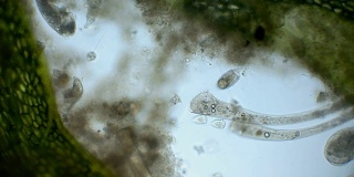 微生物，显微镜下水族馆里的居民，就像外来生物