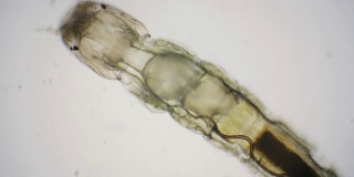 摇蚊或不咬的摇蚊幼虫通过显微镜观察