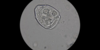 微生物，显微镜下水族馆里的居民，就像外来生物