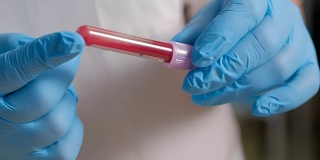 女实验室技术员戴着防护手套拿着移液管，在医院病房检测血液样本进行输血，双手要靠近。试管。血液采样、分析