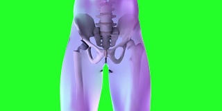 髋关节置换植入物安装在骨盆骨。医学精准3D动画