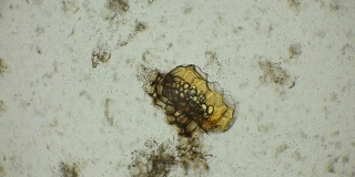 在显微镜下观察被保护壳中的微生物卵